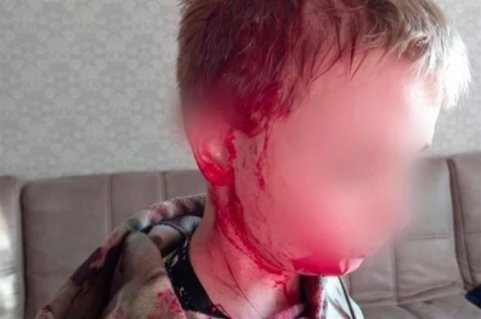 Родители первоклассника, толкнувшего мальчика и причинившего ему травму, в возможном судебном споре